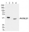 AKINB1 | SNF1-related protein kinase regulatory subunit beta-1